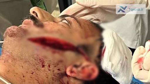 حمله با قمه در بابل: شهروند بابلی دچار فلج صورت شد