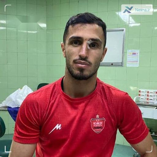 جراحت علی علی‌پور در تمرین پرسپولیس؛ مصدومیت یامگا تکرار نشد!