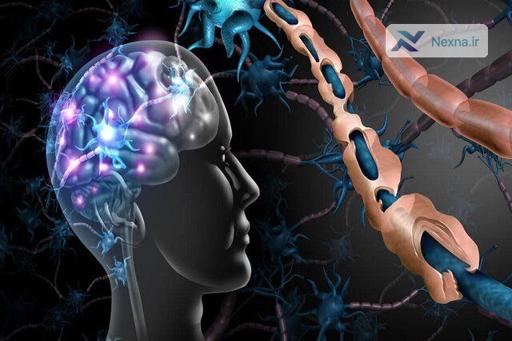 شیوع بیشتر ام‌اس در زنان ایرانی