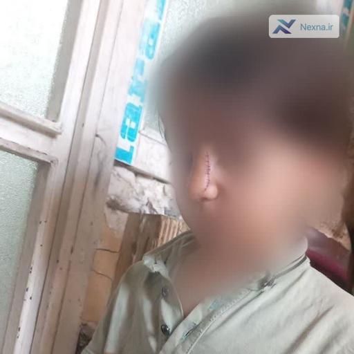 کمک فوری برای دختر آسیب دیده